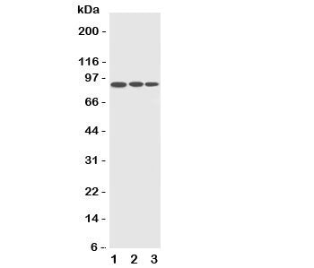 Western blot testing of CDC5L antibody and Lane 1: HeLa; 2: Raji; 3: A549 cell lysate. Predicted/observed size ~88KD