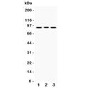 Western blot testing of SEMA3A antibody and Lane 1: 293T; 2: A549; 3: HeLa lysate. Predicted molecular weight: ~89 kDa.