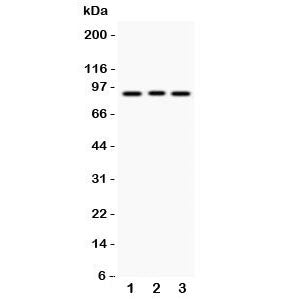 Western blot testing of SEMA3A antibody and Lane 1: 293T; 2: A549; 3: HeLa lysate. Predicted molecular weight: ~89 kDa.