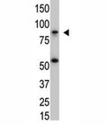 The IKK beta antibody used in western blot with SK-BR3 cell lysate. Predicted molecular weight ~87 kDa.