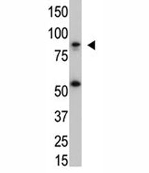 The IKK beta antibody used in western blot with SK-BR3 cell lysate. Predicted molecular weight ~87 kDa.