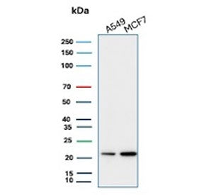 Western blot testing of human A549 and MCF7 cell lysate with recombinant Bax antibody (clone rBAX/962). Predicted molecular weight ~21 kDa.