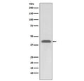 Western blot testing of human A549 cell lysate with HLA-A antibody. Predicted molecular weight ~41 kDa.