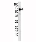 Western blot analysis of Calcineurin antibody and mouse kidney tissue lysate. Predicted molecular weight: ~62 kDa.