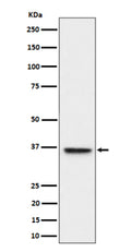 Western blot analysis of ULBP1 expression in HeLa cell lysate using ULBP1 antibody. ULBP1 (~28 kDa predicted) seen here at ~36 kDa in Western blot is consistent with its known glycosylation and postâ€translational modifications.