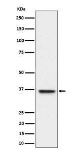 Western blot analysis of ULBP1 expression in HeLa cell lysate using ULBP1 antibody. ULBP1 (~28 kDa predicted) seen here at ~36 kDa in Western blot is consistent with its known glycosylation and postâ€translational modifications.