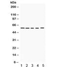 Western blot testing of 1) rat brain, 2) mouse brain, human 3) K562, 4) HeLa and 5) 22RV1 lysate with KCNA3 antibody. Expected molecular weight ~64 kDa, observed here at ~55 kDa.
