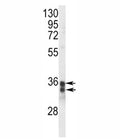 Western blot analysis of STING antibody and Jurkat lysate. Predicted molecular weight ~42/35 kDa, observed here at 33/35 kDa.
