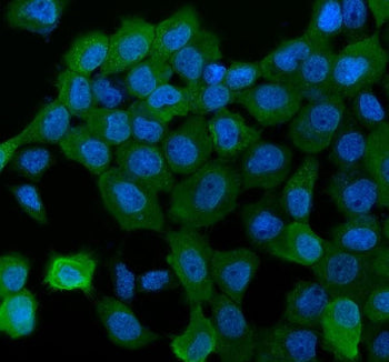 Western blot testing of NDRG1 antibody and SMMC-7721 nuclear (1) and cytoplasmic (2) fraction. Predicted molecular weight ~43kDa.