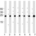 Cebpd antibody western blot analysis in 1) A549, 2) HeLa, 3) NCI-H460, 4) U-937, 5) mouse NIH3T3 cell line, rat 6) lung and 7) testis tissue lysate.
