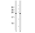 Western blot testing of human 1) cerebellum and 2) spleen tissue lysate with Grancalcin antibody at 1:2000. Predicted molecular weight ~24 kDa.