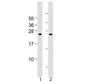 Western blot testing of human 1) cerebellum and 2) spleen tissue lysate with Grancalcin antibody at 1:2000. Predicted molecular weight ~24 kDa.