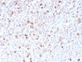 IHC staining of FFPE human spleen with recombinant Lambda antibody (clone LLC/3778R). HIER: boil tissue sections in pH 9 10mM Tris with 1mM EDTA for 20 min and allow to cool before testing.