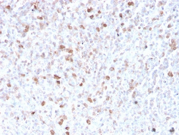 IHC staining of FFPE human spleen with recombinant Lambda antibody (clone LLC/3778R). HIER: boil tissue sections in pH 9 10mM Tris with 1mM EDTA for 20 min and allow to cool before testing.