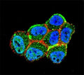 Confocal immunofluorescent analysis of LKB1 antibody with ZR-75-1 cells followed by Alexa Fluor 488-conjugated goat anti-rabbit lgG (green). Actin filaments have been labeled with Alexa Fluor 555 Phalloidin (red). DAPI was used as a nuclear counterstain (blue).