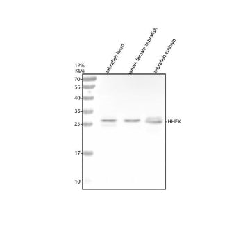 Western blot analysis of Hhex protein using Zebrafish Hhex antibody and 1) zebrafish head, 2) whole female zebrafish and 3) zebrafish embryo tissue lysate. Predicted molecular weight ~26 kDa.