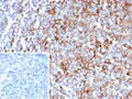 IHC staining of FFPE human tonsil tissue with CD63 antibody (clone rLAMP3/8604). Inset: PBS used in place of primary Ab (secondary Ab negative control). HIER: boil tissue sections in pH 9 10mM Tris with 1mM EDTA for 20 min and allow to cool before testing.