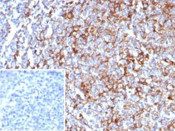 IHC staining of FFPE human tonsil tissue with CD63 antibody (clone rLAMP3/8604). Inset: PBS used in place of primary Ab (secondary Ab negative control). HIER: boil tissue sections in pH 9 10mM Tris with 1mM EDTA for 20 min and allow to cool before testing.
