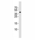 Western blot analysis of lysate from rat brain tissue lysate using Isl1 antibody at 1:1000. Predicted molecular weight ~39 kDa.