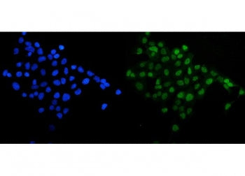Immunofluorescent staining of FFPE human A431 cells with SIRT1 antibody (green) and DAPI nuclear stain (blue). HIER: steam section in pH6 citrate buffer for 20 min.