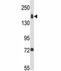 Western blot analysis of Integrin alpha 2 antibody and MDA-MB231 lysate