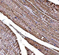 IHC staining of FFPE human skeletal muscle tissue with DOK7 antibody. HIER: boil tissue sections in pH8 EDTA for 20 min and allow to cool before testing.