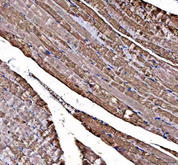 IHC staining of FFPE human skeletal muscle tissue with DOK7 antibody. HIER: boil tissue sections in pH8 EDTA for 20 min and allow to cool before testing.