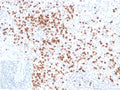 IHC staining of FFPE human spleen tissue with Lysozyme antibody (clone LYZ/3941). Inset: PBS used in place of primary Ab (secondary Ab negative control). HIER: boil tissue sections in pH 9 10mM Tris with 1mM EDTA for 20 min and allow to cool before testing.