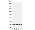 Western blot testing of Glutaredoxin 2 antibody and Lane 1: rat testis; and human samples 2: HeLa; 3: U87; 4: NEU; 5: Jurkat; 6: MCF-7 cell lysate