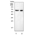 Western blot testing of 1) rat brain and 2) mouse brain with MPP2 antibody at 0.5ug/ml. Predicted molecular weight: isoforms of ~46 kDa and 60-67 kDa.