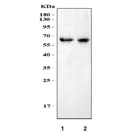 Western blot testing of 1) rat brain and 2) mouse brain with MPP2 antibody at 0.5ug/ml. Predicted molecular weight: isoforms of ~46 kDa and 60-67 kDa.