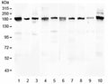 Western blot testing of 1) human placenta 2) human U-2 OS, 3) human HeLa, 4) rat brain, 5) rat lung, 6) mouse brain, 7) mouse lung, 8) mouse kidney, 9) mouse spleen and 10) mouse Neuro-2a lysate with PCDH15 antibody at 0.5ug/ml. Isoforms have been observed with molecular weights of: 250, 180, 160, 130, 90 and 60 kDa.
