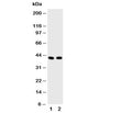Western blot testing of HDAC8 antibody and Lane 1: rat heart; 2: human A549 cell lysate