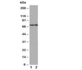 Western blot testing of ABCG4 antibody; Lane 1: rat brain; 2: mouse brain tissue lysate. Predicted molecular weight 60-80 kDa