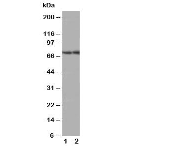Western blot testing of ABCG4 antibody; Lane 1: rat brain; 2: mouse brain tissue lysate. Predicted molecular weight 60-80 kDa