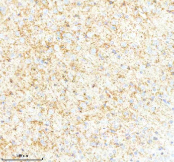 IHC analysis of SYNPR using anti-SYNPR antibody. SYNPR was detected in a paraffin-embedded section of mouse brain tissue. Heat mediated antigen retrieval was performed in EDTA buffer (pH 8.0, epitope retrieval solution). The tissue section was blocked with 10% goat serum. The tissue section was then incubated with 2 ug/ml rabbit anti-SYNPR antibody overnight at 4oC. Peroxidase Conjugated Goat Anti-rabbit IgG was used as secondary antibody and incubated for 30 min at 37oC.
