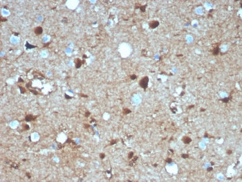 IHC staining of FFPE human brain tissue with S100B antibody (clone S100B/4139). HIER: boil tissue sections in pH 9 10mM Tris with 1mM EDTA for 20 min and allow to cool before testing.