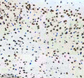 IHC staining of FFPE mouse brain tissue with p73 antibody, HRP-labeled secondary and DAB substrate. HIER: boil tissue sections in pH8 EDTA for 20 min and allow to cool before testing.
