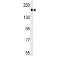 Western blot analysis of ACE antibody and mouse lung tissue lysate. Expected molecular weight 140-170 kDa.