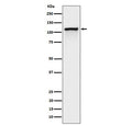 Western blot testing of lysate from pervanadate-treated human Jurkat cells with Phospho-CBL antibody.