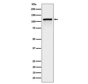 Western blot testing of lysate from pervanadate-treated human Jurkat cells with Phospho-CBL antibody.