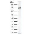Western blot testing of human small intestine lysate with Cadherin 17 antibody (clone CDH17/2617). Predicted molecular weight ~92 kDa but may be observed at higher molecular weights due to glycosylation.
