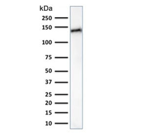 Western blot testing of human small intestine lysate with Cadherin 17 antibody (clone CDH17/2617). Predicted molecular weight ~92 kDa but may be observed at higher molecular weights due to glycosylation.