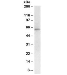Western blot testing of peripheral blood mononucleocyte lysate with G6PD antibody at 1ug/ml. Predicted molecular weight ~59kDa.