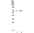 Western blot testing of 1) rat heart and 2) mouse heart lysate with PMEL17 antibody at 0.5ug/ml. Predicted molecular weight: ~70 kDa (unmodified), ~100 kDa (glycosylated).