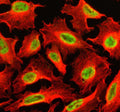 Immunofluorescent staining of SETBP1 using anti-SETBP1 antibody (green) and anti-Beta Tubulin antibody (red). SETBP1 was detected in an immunocytochemical section of U2OS cells. Enzyme antigen retrieval was performed using IHC enzyme antigen retrieval reagent for 15 mins. The cells were blocked with 10% goat serum. And then incubated with 5 ug/ml rabbit anti-SETBP1 antibody and mouse anti-Beta Tubulin antibody overnight at 4oC.