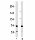 SDHA antibody western blot analysis in 1) human HeLa and 2) mouse C2C12 lysate. Predicted molecular weight ~72 kDa.
