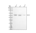Western blot analysis of NOXA1 using anti-NOXA1 antibody. Lane 1: human MCF-7 whole cell lysates, Lane 2: human RT4 whole cell lysates, Lane 3: human Caco-2 whole cell lysates. After electrophoresis, proteins were transferred to a nitrocellulose membrane at 150 mA for 50-90 min. Blocked the membrane with 5% non-fat milk/TBS for 1.5 hour at RT.