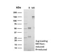 SDS-PAGE Analysis of Purified, BSA-Free CD18 Antibody (clone 68-5A5). Confirmation of Integrity and Purity of the Antibody.