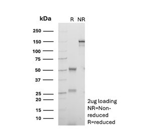 SDS-PAGE Analysis of Purified, BSA-Free CD18 Antibody (clone 68-5A5). Confirmation of Integrity and Purity of the Antibody.